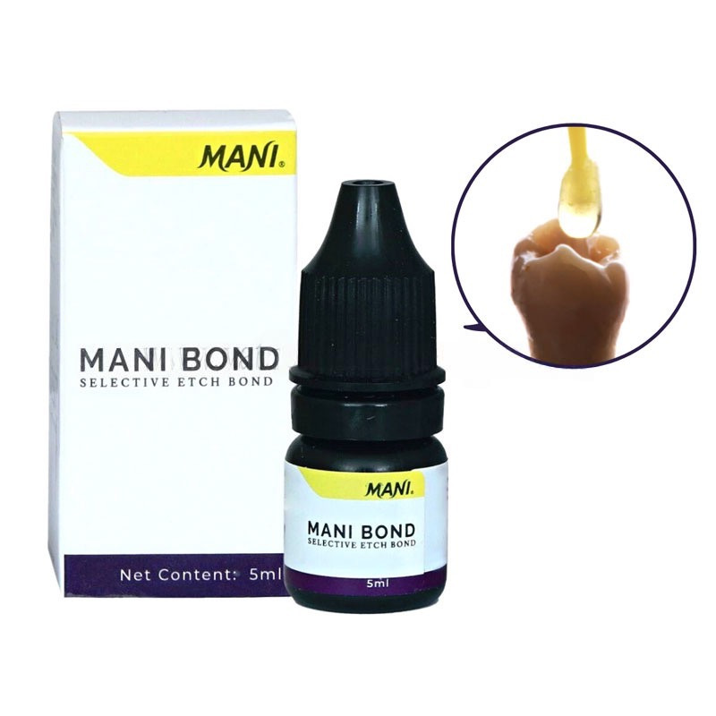 Bond trám răng 1 bước Mani bond selective etch bond | Mani Nhật Bản