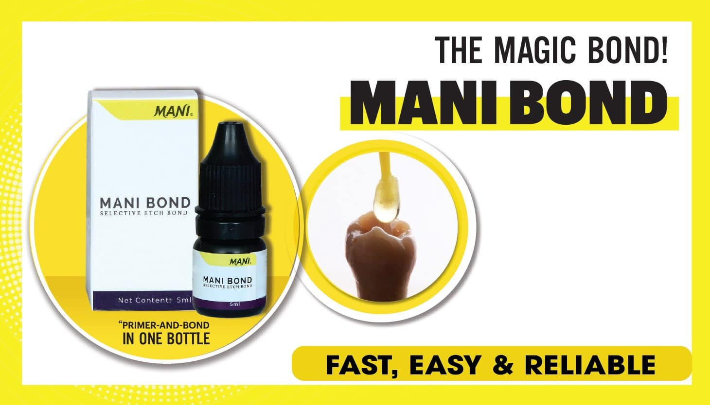 Bond trám răng 1 bước Mani bond selective etch bond | Mani Nhật Bản