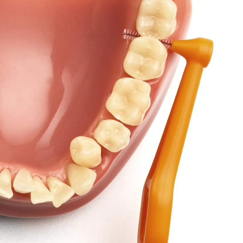 Bàn chải kẽ răng Angle | Tepe Thụy Điển