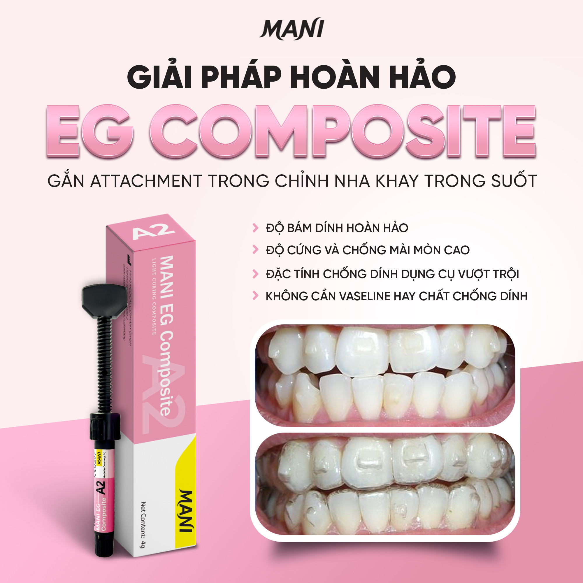 Composite Đặc Mani EG Mani Nhật Bản