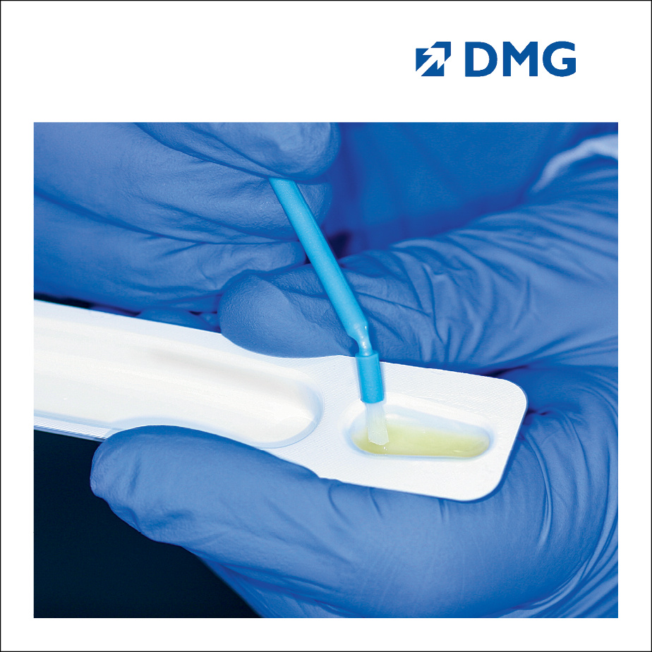 Dự phòng sâu răng Vecni Flairesse