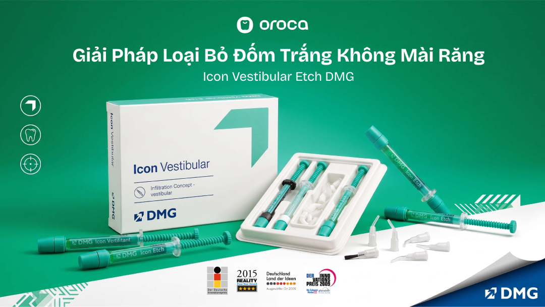 Icon Vestibular Etch DMG: Giải Pháp Loại Bỏ Đốm Trắng Không Mài Răng