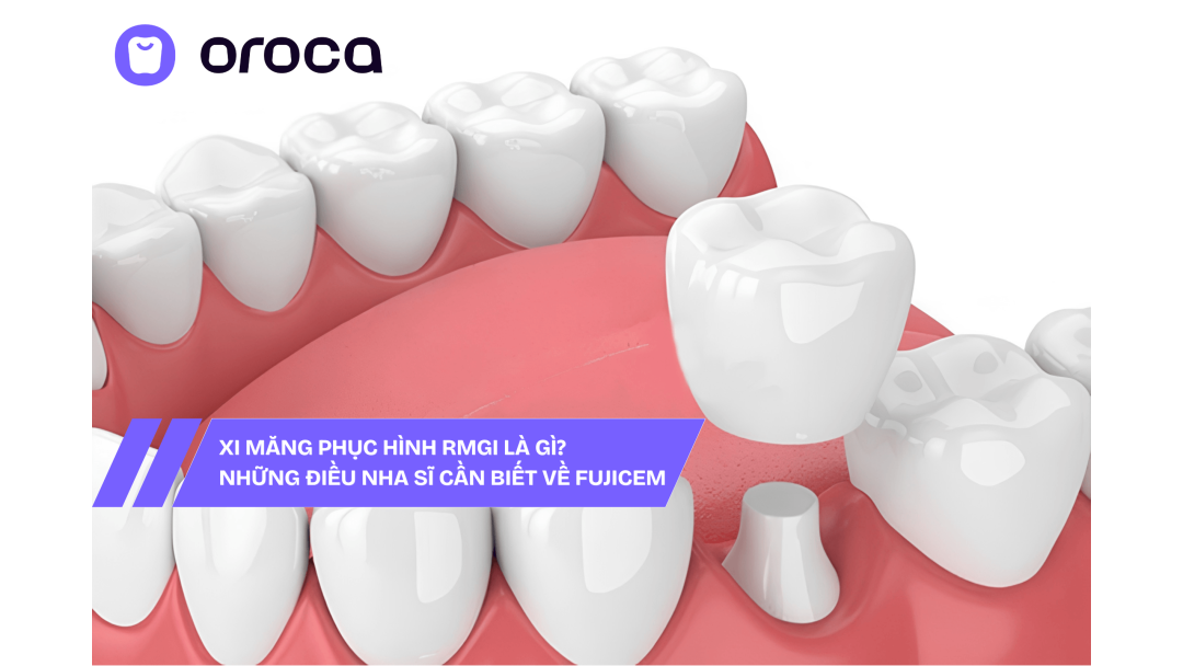 Xi Măng Gắn Phục Hình RMGI Là Gì? Những Điều Nha Sĩ Cần Biết Về FujiCEM