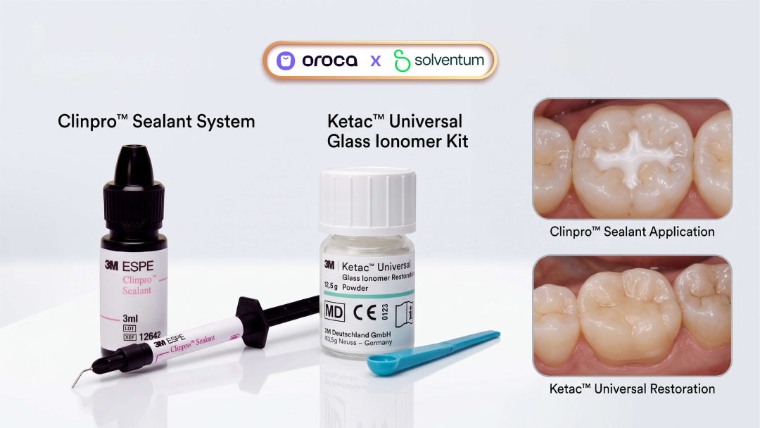 Xi Măng Trám Bít Hố Rãnh 3M Solventum: Chọn Dòng Nào Để Không Bong Sút?