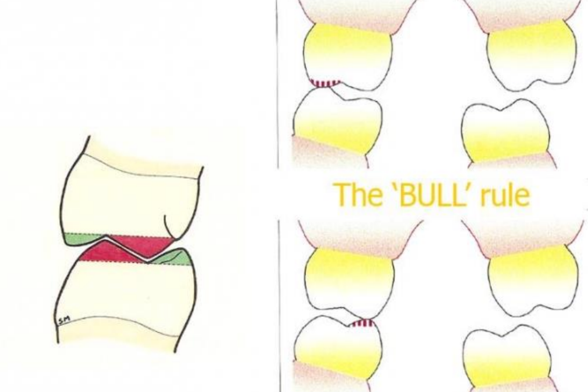 BULL-rule